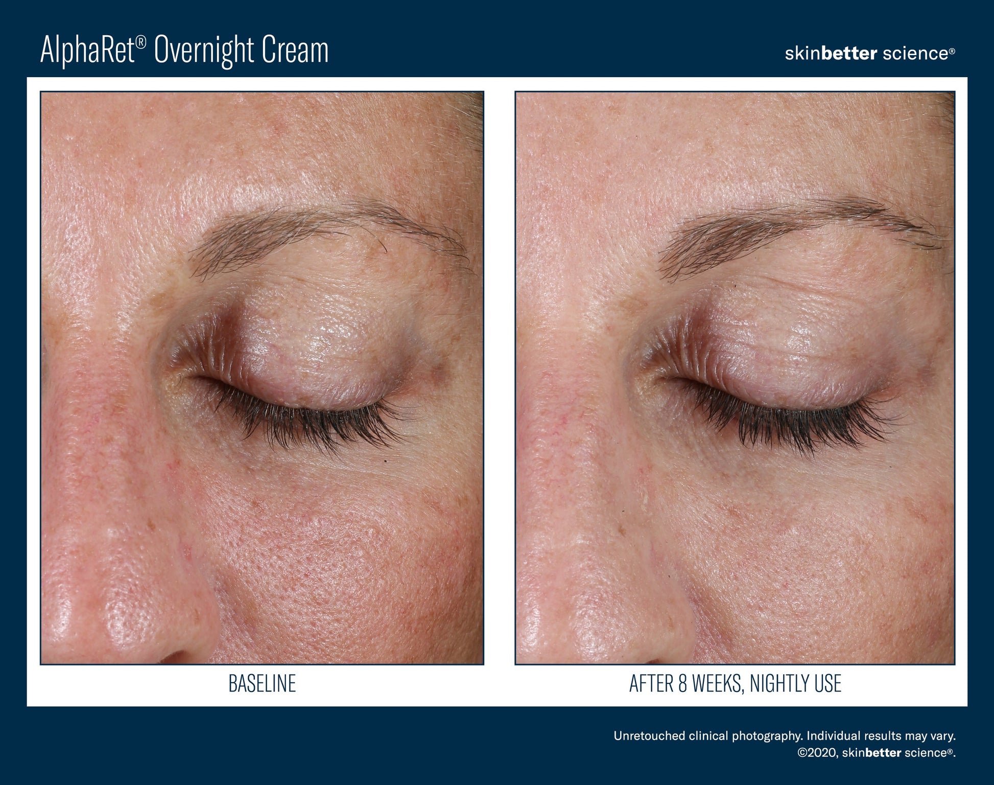 AlphaRet Overnight Cream 30 ml