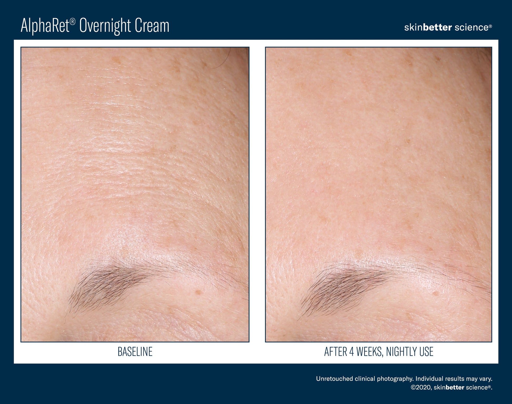 AlphaRet Overnight Cream 50 ml