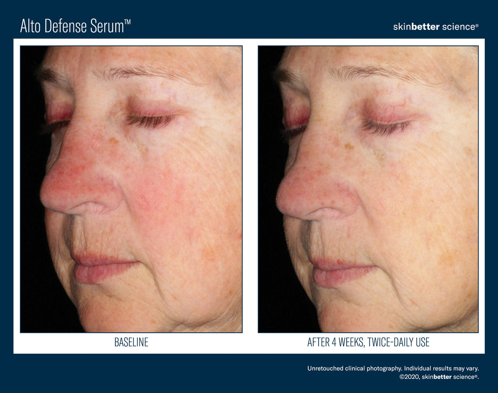 Alto Defense Serum 30 ml