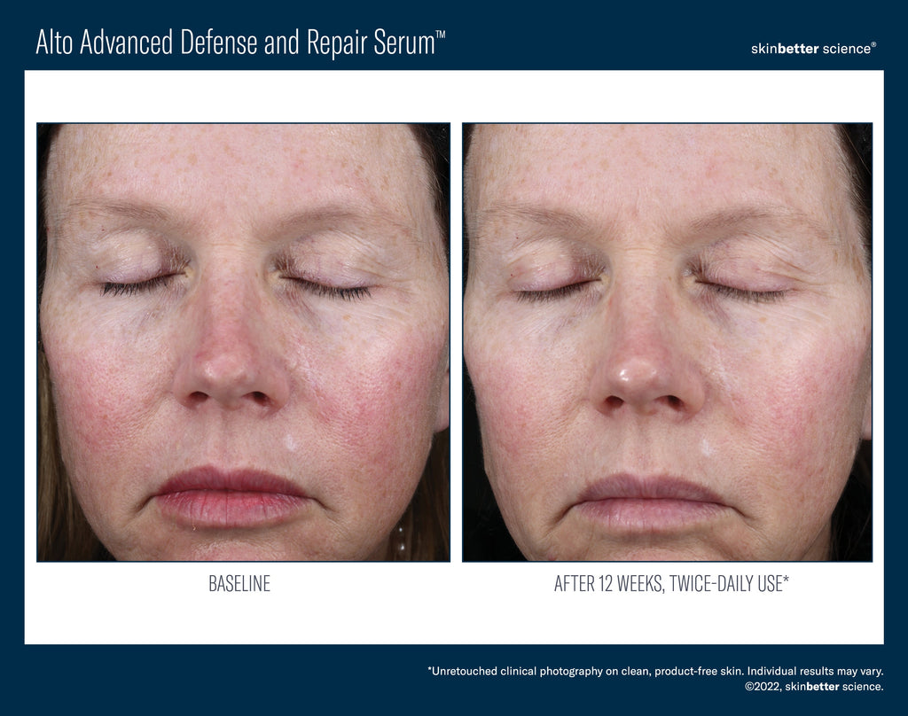 Alto Advanced Defense and Repair Serum 30 ml