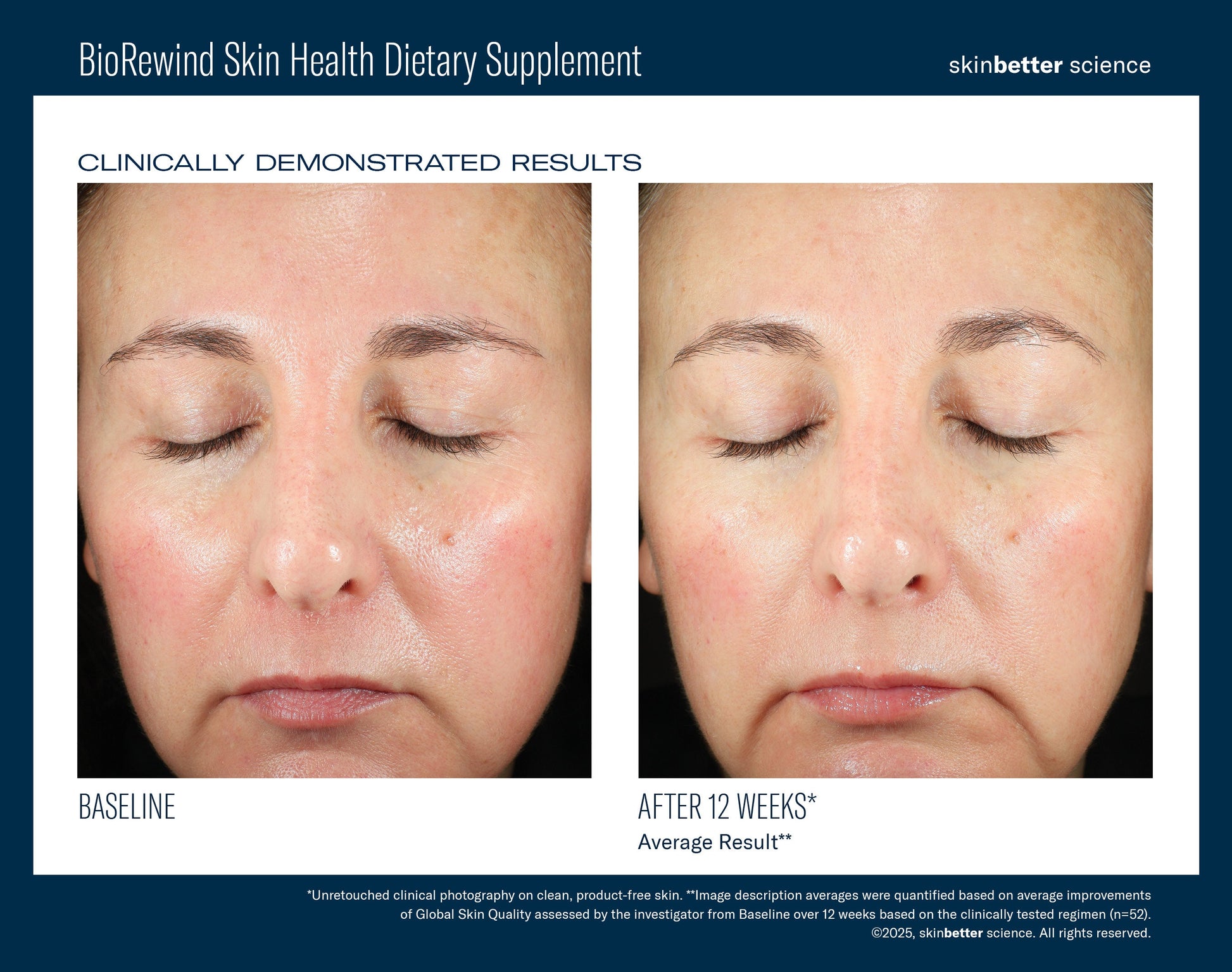 BioRewind Skin Health Dietary Supplement