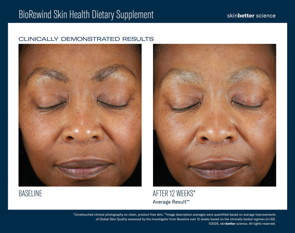 BioRewind Skin Health Dietary Supplement