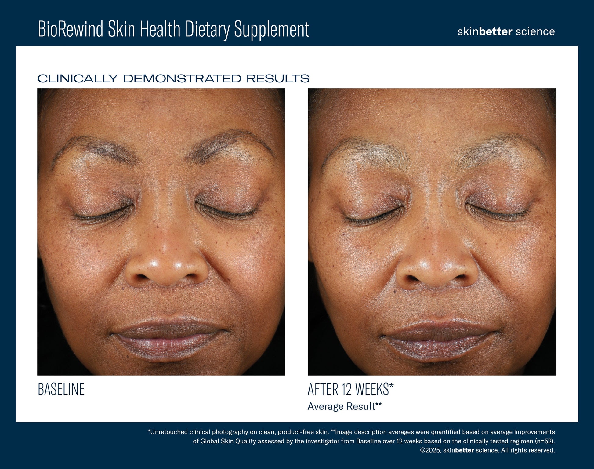 BioRewind Skin Health Dietary Supplement