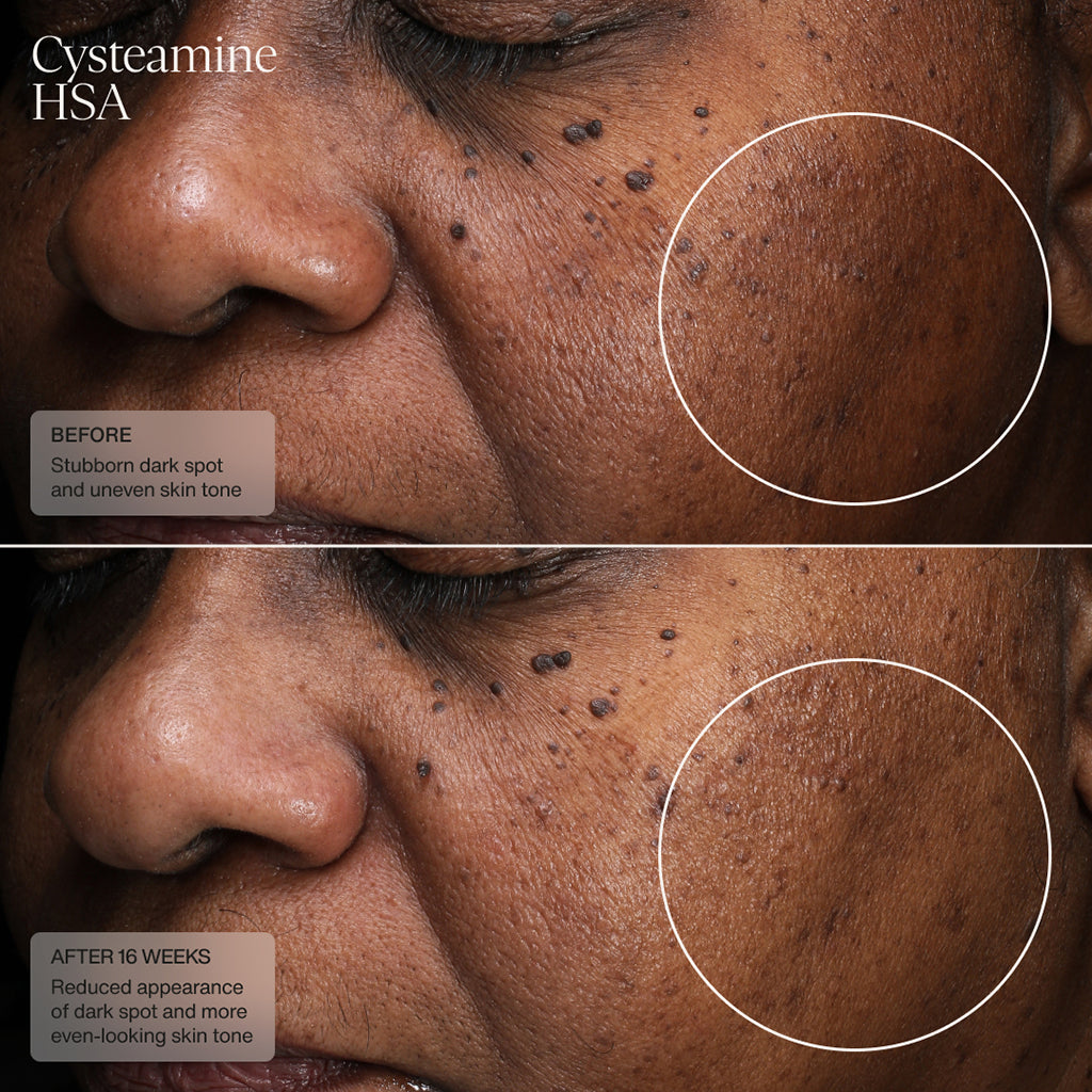 Cysteamine HSA Pigment & Tone Corrector