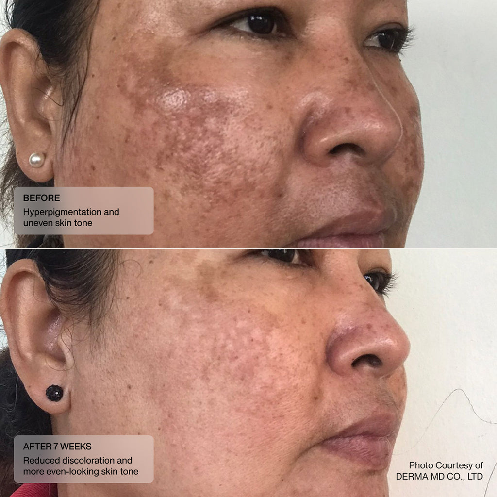 Even Tone Retinol Cream