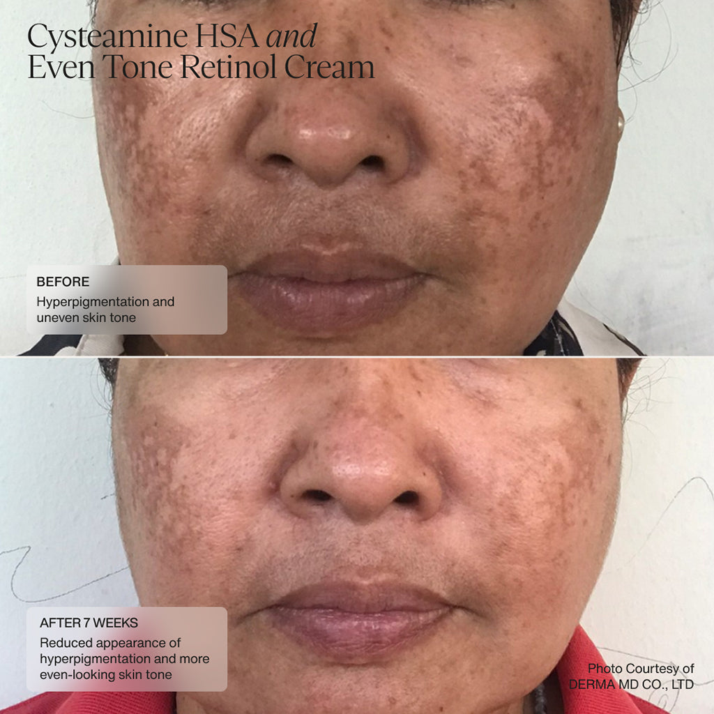 Cysteamine HSA Pigment & Tone Corrector