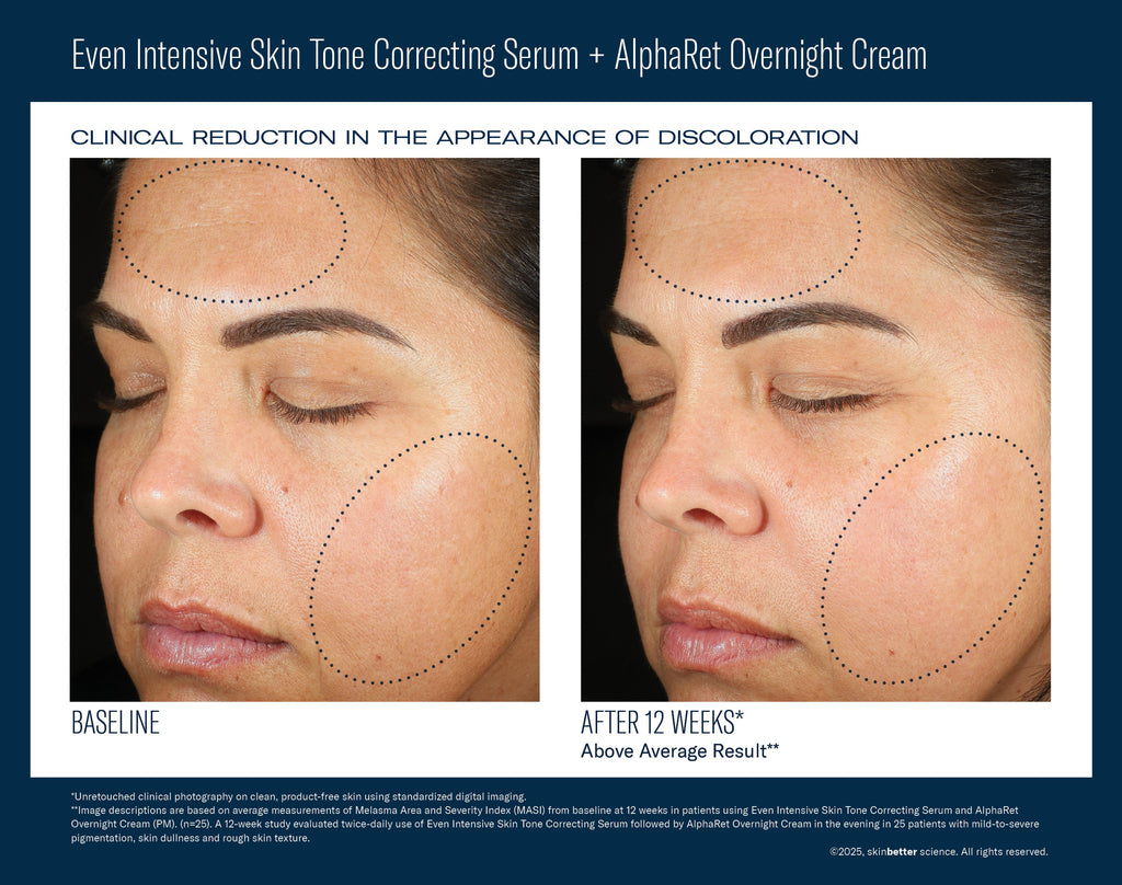 Even Intensive Skin Tone Correcting Serum 50 ml