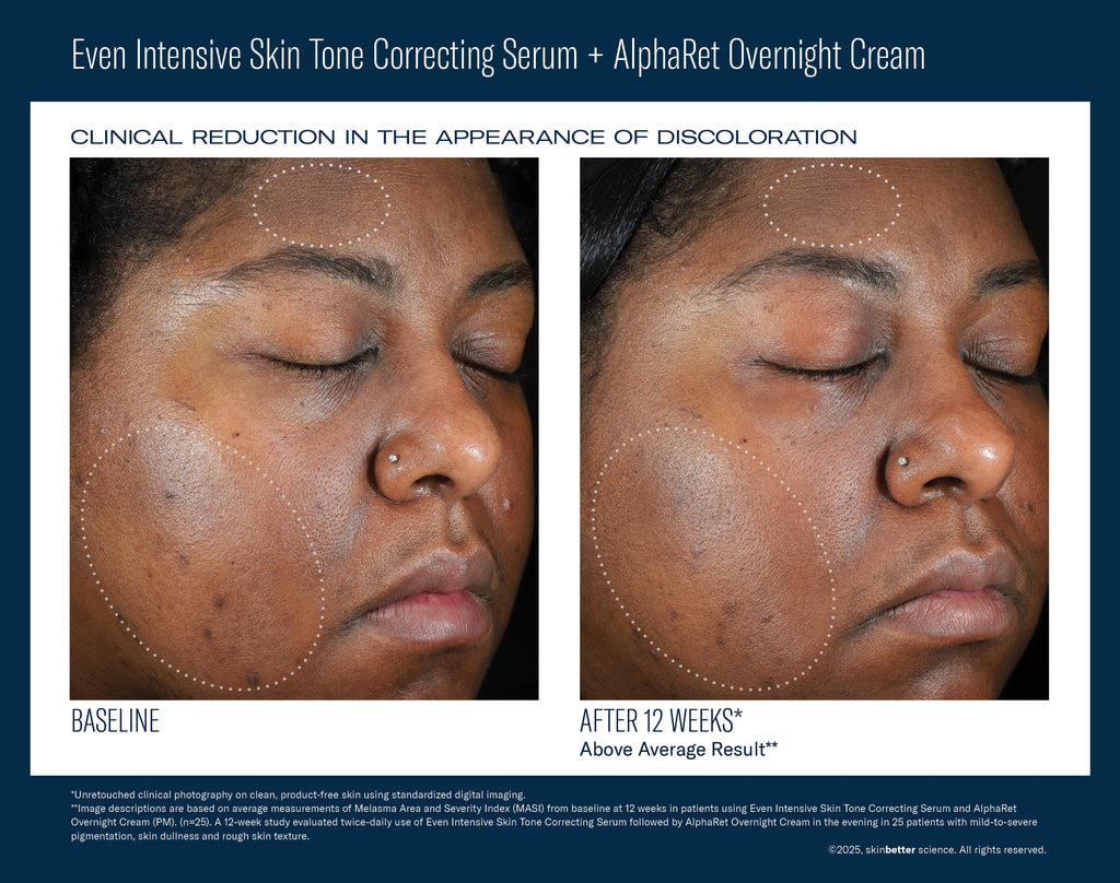 Even Intensive Skin Tone Correcting Serum 50 ml