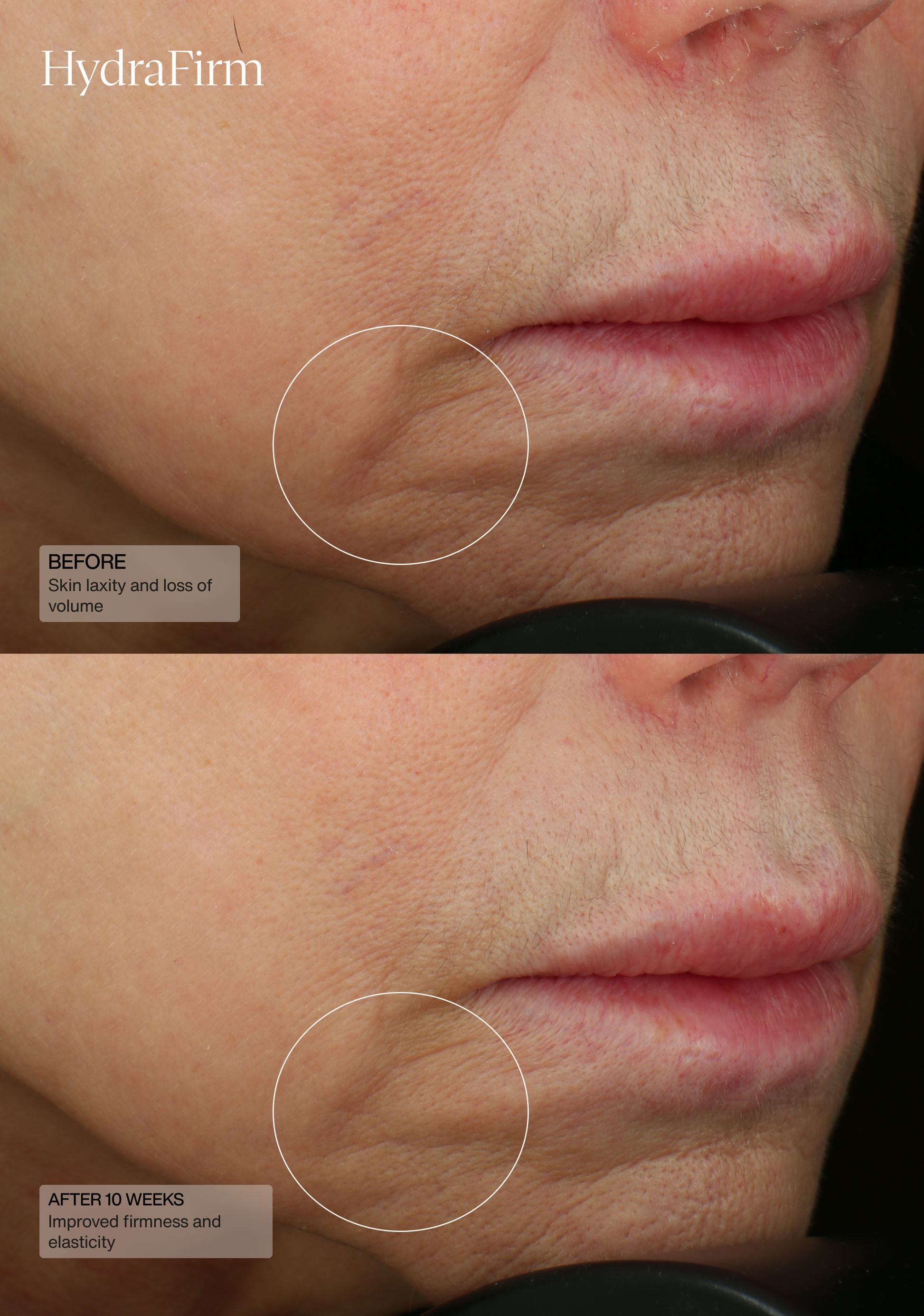 Hydrafirm (Dermal Contour Pressed Serum)