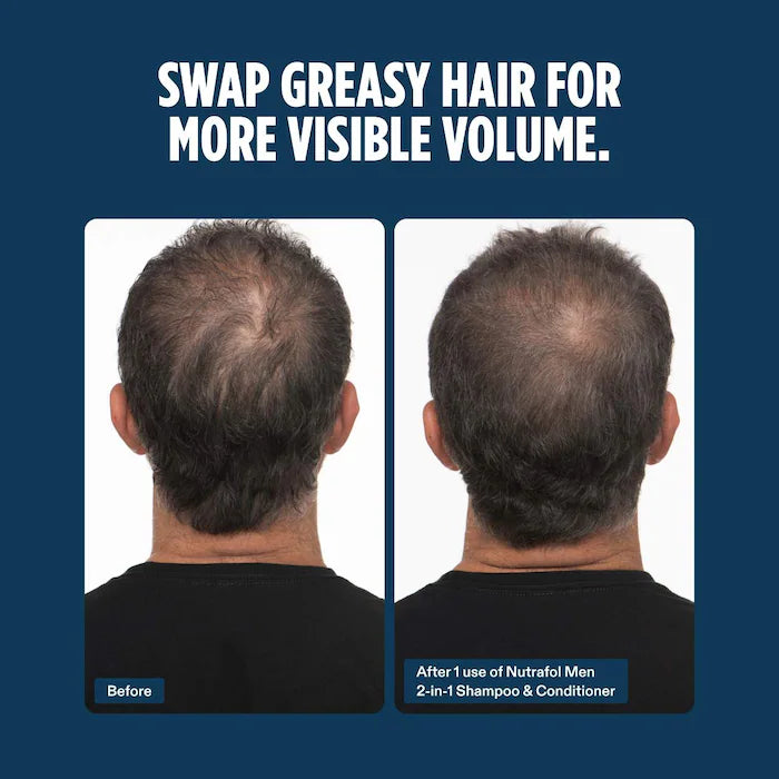 Men Active Cleanse Scalp Microbiome