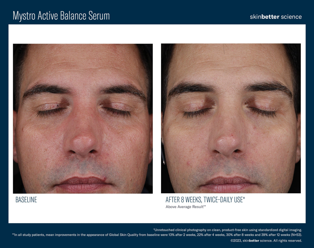 Mystro Active Balance Serum 30 ml