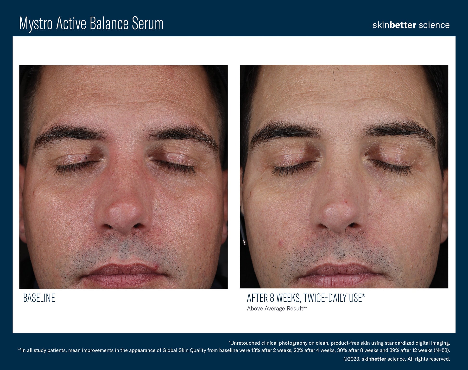 Mystro Active Balance Serum 30 ml