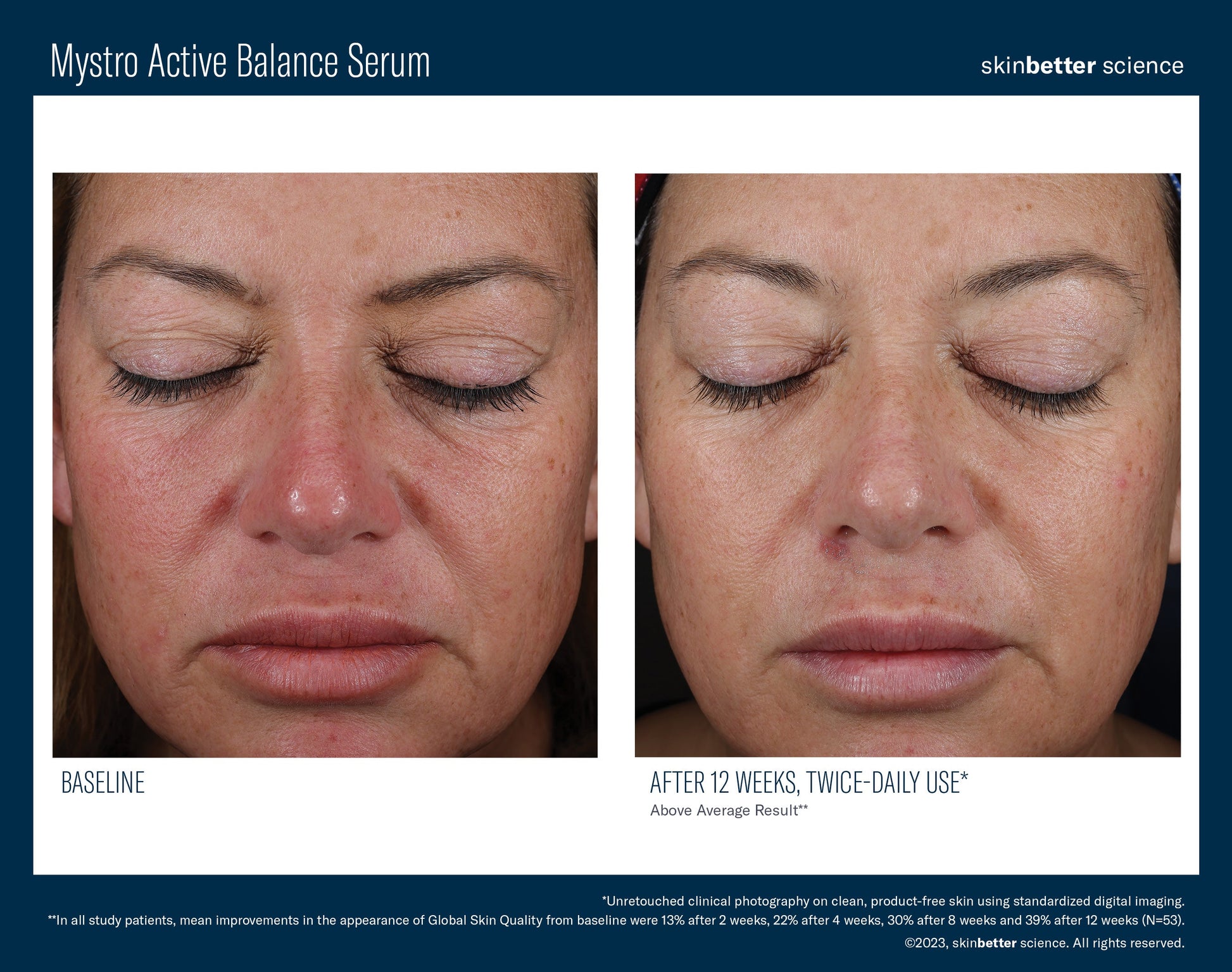 Mystro Active Balance Serum 30 ml