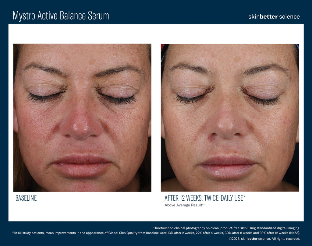 Mystro Active Balance Serum 50 ml