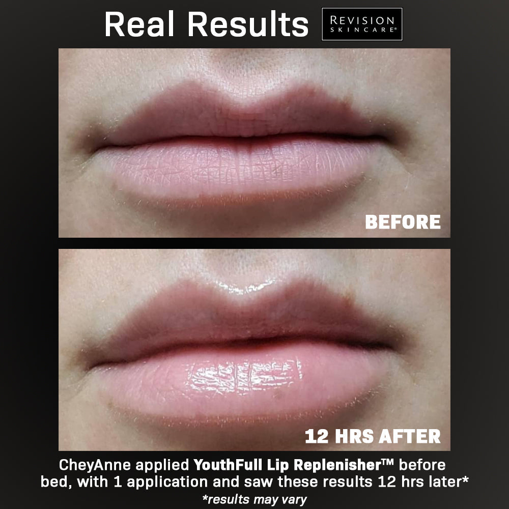 Youthful Lip Replenisher