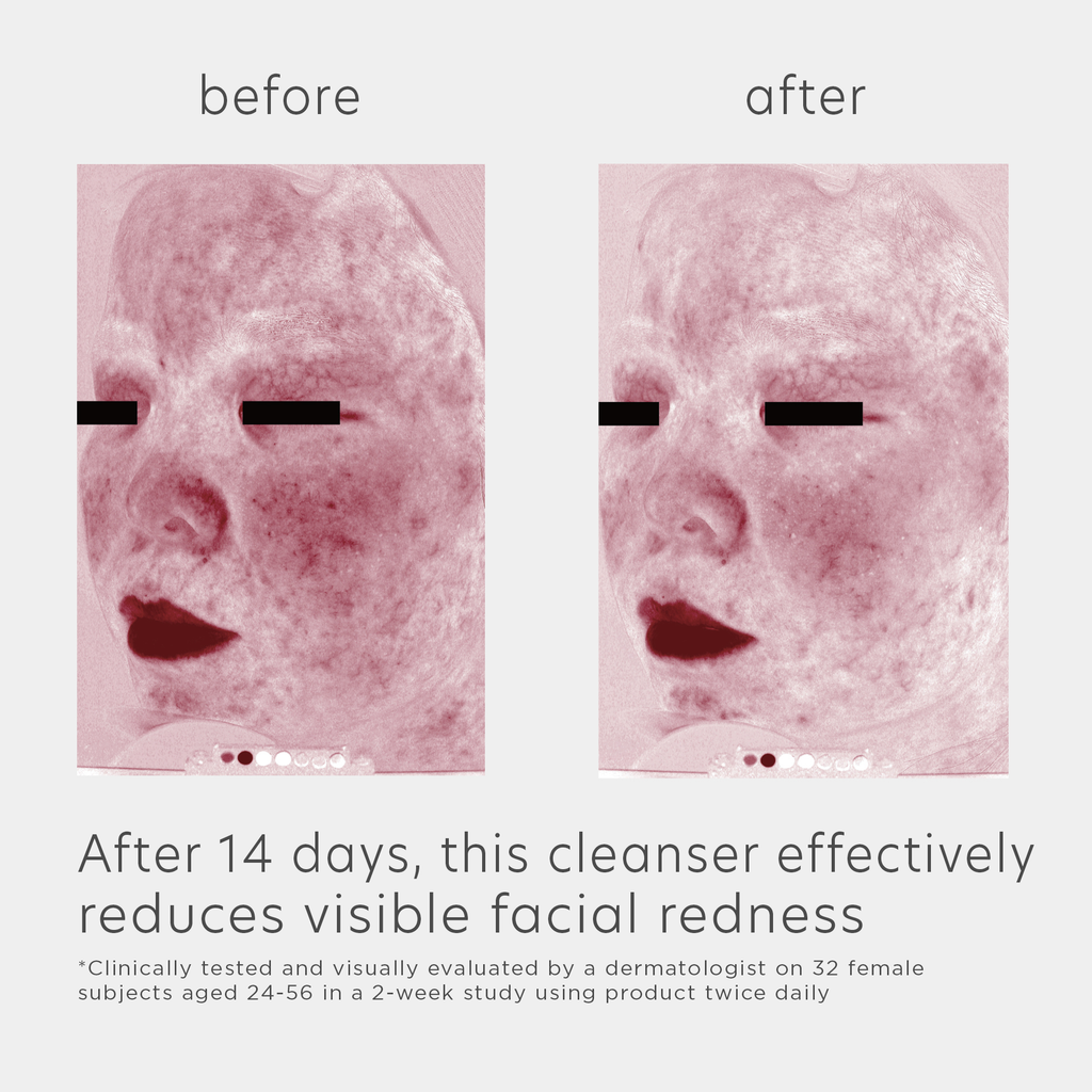 Skin Recovery Amino Acid Foaming Cleanser