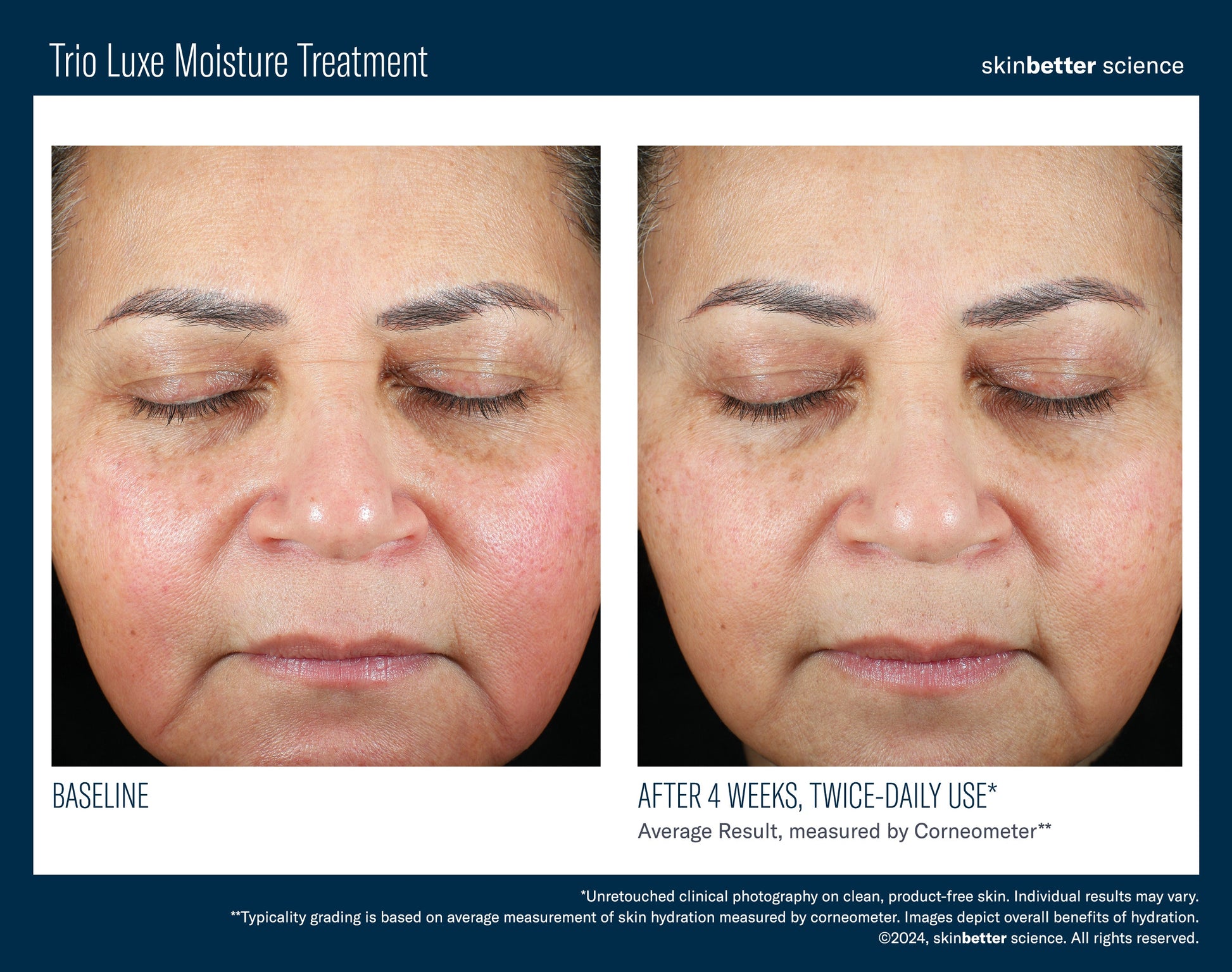 Trio Luxe Moisture Treatment